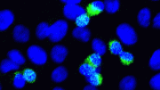 SARS-CoV-2 Replication Is Suppressed by RIG-I