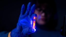 A Vial of Fluorescent Dye Molecules in Solution