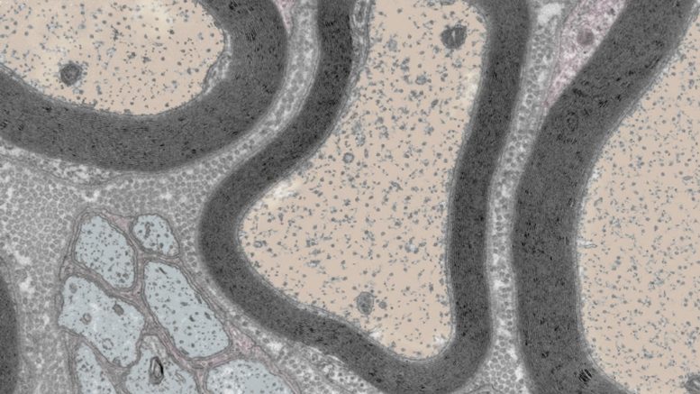 Cross Section of Mouse Sciatic Nerves