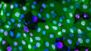 Gut Cells at Different Stages of Erebosis