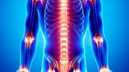 Joint Pain Spine