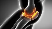 Knee Cartilage Illustration