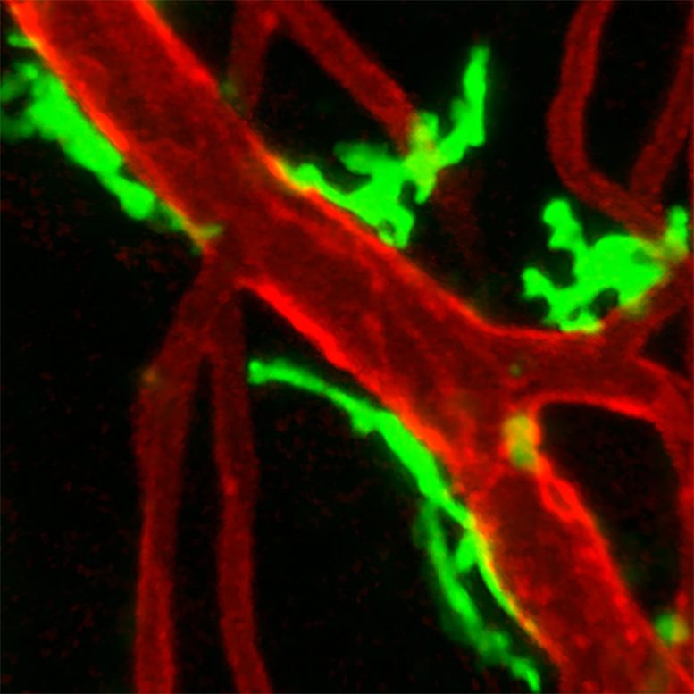 Macrophages Blood Vessels Damaged Tissue