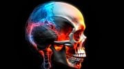 Newly Discovered Bone Stem Cell Causes Premature Skull Fusion