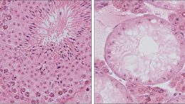 Normal and Impaired Spermatogenesis