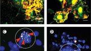 Squamous Epithelial Cell Biofilms