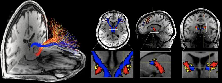 Structural Connections With Prefrontal Cortex