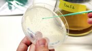 Yeast Cultures Studying Aging