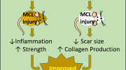 New Treatment for Ligament Injuries